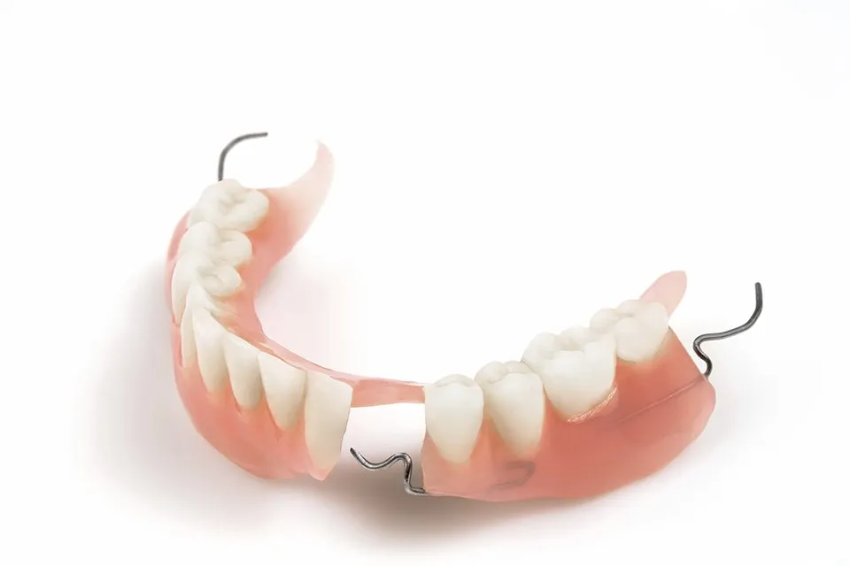 Removable partial denture for replacing missing teeth